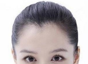 注射玻尿酸丰额头是否安全呢