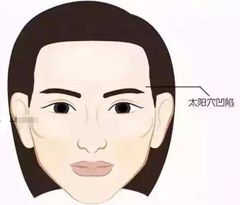 太阳穴凹陷显得很难看怎么办